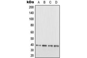 Western blot analysis of EB3 expression in SHSY5Y (A), HeLa (B), SP2/0 (C), PC12 (D) whole cell lysates. (MAPRE3 抗体  (C-Term))