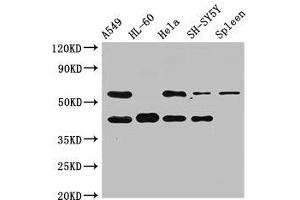 Western Blot Positive WB detected in: A549 whole cell lysate, HL60 whole cell lysate, Hela whole cell lysate, SH-SY5Y whole cell lysate, Rat spleen tissue All lanes: BACE2 antibody at 2. (BACE2 抗体  (AA 84-157))