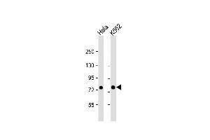 Western Blot at 1:1000 dilution Lane 1: Hela whole cell lysate Lane 2: K562 whole cell lysate Lysates/proteins at 20 ug per lane.