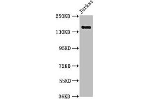 Western Blot Positive WB detected in: Jurkat whole cell lysate All lanes: CARMIL2 antibody at 1:1000 Secondary Goat polyclonal to rabbit IgG at 1/50000 dilution Predicted band size: 155, 149 kDa Observed band size: 155 kDa (RLTPR 抗体  (AA 1136-1290))