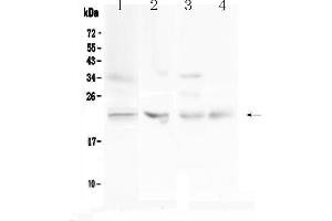 Western blot analysis of TIMP1 using anti-TIMP1 antibody . (TIMP1 抗体  (AA 24-207))