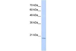 WB Suggested Anti-RBM39 Antibody Titration:  0. (RBM39 抗体  (Middle Region))