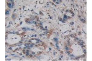 IHC-P analysis of Human Pancreas Tissue, with DAB staining. (Villin 1 抗体  (AA 1-320))
