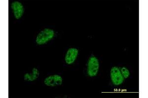 Immunofluorescence of purified MaxPab antibody to SYMPK on HeLa cell. (Symplekin 抗体  (AA 1-533))