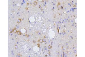 Paraformaldehyde-fixed, paraffin embedded Mouse brain, Antigen retrieval by boiling in sodium citrate buffer (pH6) for 15min, Block endogenous peroxidase by 3% hydrogen peroxide for 30 minutes, Blocking buffer at 37°C for 20min, Antibody incubation with IRF1 (3G7) Monoclonal Antibody  at 1:50 overnight at 4°C, followed by a conjugated secondary and DAB staining. (IRF1 抗体)
