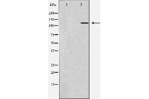 Western blot analysis of Hela whole cell lysates, using ZEB1 Antibody. (ZEB1 抗体  (Internal Region))