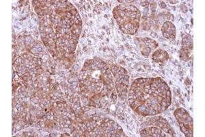 IHC-P Image Immunohistochemical analysis of paraffin-embedded SW480 xenograft, using FBXL2, antibody at 1:500 dilution. (FBXL2 抗体  (N-Term))