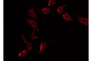 ABIN6269303 staining HuvEc by IF/ICC. (FOXO4 抗体  (C-Term))