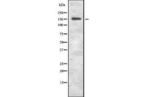 Western blot analysis of GRIN2A using A549 whole  lysates.
