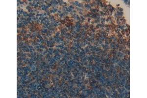 Immunohistochemistry (IHC) image for anti-Killer Cell Lectin-Like Receptor Subfamily K, Member 1 (KLRK1) (AA 92-216) antibody (ABIN7444379)