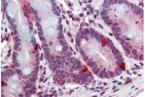 Human Small Intestine: Formalin-Fixed, Paraffin-Embedded (FFPE) (ARL2 抗体  (AA 123-184))