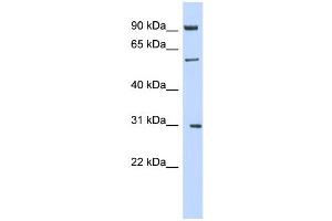 WB Suggested Anti-MGAT2 Antibody Titration:  0.