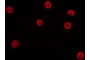 ABIN6275736 staining HepG2 by IF/ICC. (IKZF4 抗体  (C-Term))
