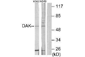 Western blot analysis of extracts from K562 cells and A549 cells, using DAK antibody. (DAK 抗体  (Internal Region))
