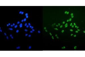 IF analysis of Ku70 using anti-Ku70 antibody (ABIN7602790).