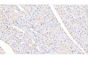 Detection of FGF1 in Porcine Cardiac Muscle Tissue using Polyclonal Antibody to Fibroblast Growth Factor 1, Acidic (FGF1) (FGF1 抗体  (AA 12-151))