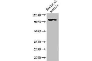 Western Blot Positive WB detected in: Mouse skeletal muscle tissue All lanes: SLFN11 antibody at 2. (SLFN11 抗体  (AA 670-821))