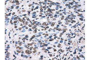 Immunohistochemical staining of paraffin-embedded pancreas tissue using anti-HDAC10mouse monoclonal antibody. (HDAC10 抗体)