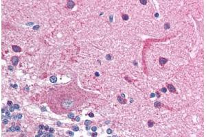 Human Brain, Cerebellum (formalin-fixed, paraffin-embedded) stained with HDAC6 antibody ABIN214772 at 5 ug/ml followed by biotinylated goat anti-rabbit IgG secondary antibody ABIN481713, alkaline phosphatase-streptavidin and chromogen. (HDAC6 抗体  (AA 69-118))