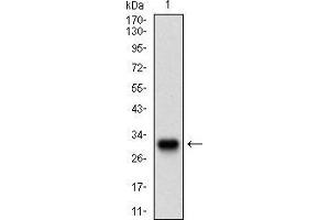 Western blot analysis using TWIST1 mAb against human TWIST1 recombinant protein. (TWIST1 抗体  (AA 9-74))