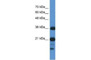 WB Suggested Anti-C1orf144  Antibody Titration: 0. (C1orf144 抗体  (N-Term))