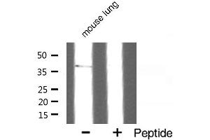 Western blot analysis of SUCNR1 expression in mouse lung. (SUCNR1 抗体  (Internal Region))