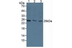 Figure. (TK1 抗体  (AA 2-234))