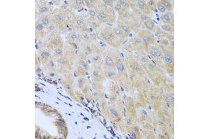 Immunohistochemistry of paraffin-embedded human liver using IL5 antibody (ABIN5975164) at dilution of 1/100 (40x lens).