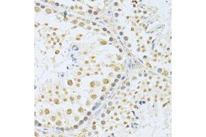 Immunohistochemistry (Paraffin-embedded Sections) (IHC (p)) image for anti-V-Akt Murine Thymoma Viral Oncogene Homolog 1 (AKT1) (C-Term) antibody (ABIN6136733)