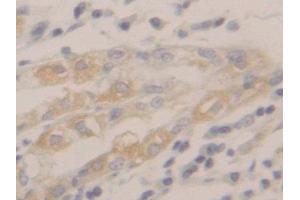 IHC-P analysis of Human Stomach Tissue, with DAB staining. (Peroxiredoxin 2 抗体  (AA 6-164))