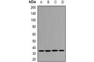 Western blot analysis of DHRS9 expression in HT29 (A), THP1 (B), mouse pancreas (C), rat trachea (D) whole cell lysates. (DHRS9 抗体)