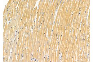 ABIN6265808 and ABIN6272545 at 1/100 staining Rat heart tissue by IHC-P. (NPRL2 抗体  (C-Term))