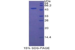 SDS-PAGE analysis of Rat FSIP1 Protein. (FSIP1 蛋白)