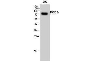Western Blotting (WB) image for anti-Protein Kinase C, theta (PRKCQ) (Thr319) antibody (ABIN3186479) (PKC theta 抗体  (Thr319))