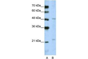 Western Blotting (WB) image for anti-WD Repeat Domain 12 (WDR12) antibody (ABIN2462386)