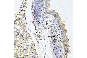 Immunohistochemistry of paraffin-embedded mouse lung using RHOT1 antibody (ABIN5973450) at dilution of 1/100 (40x lens). (RHOT1 抗体)