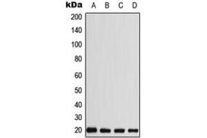 Western blot analysis of CABP5 expression in MDMB435 (A), HEK293T (B), SP2/0 (C), H9C2 (D) whole cell lysates.