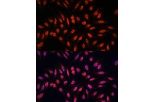 Immunofluorescence analysis of U-2 OS cells using KLHL8 antibody (ABIN7268081) at dilution of 1:100. (KLHL8 抗体  (AA 271-620))