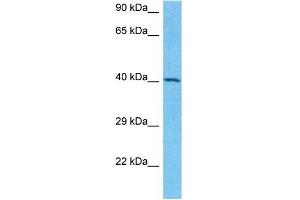 Host:  Rabbit  Target Name:  SNIP1  Sample Type:  Jurkat Whole Cell lysates  Antibody Dilution:  1. (SNIP1 抗体  (C-Term))
