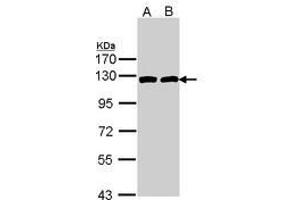 Image no. 1 for anti-ATP Citrate Lyase (ACLY) (AA 793-1008) antibody (ABIN467566) (ACLY 抗体  (AA 793-1008))