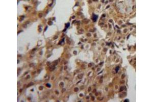 Used in DAB staining on fromalin fixed paraffin-embedded ovary tissue (PPIA 抗体  (AA 2-164))