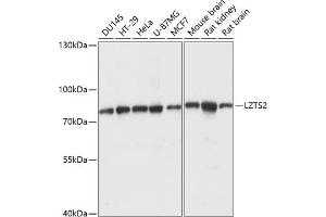 Western blot analysis of extracts of various cell lines, using LZTS2 antibody (ABIN7268227) at 1:1000 dilution. (LZTS2 抗体  (AA 470-669))