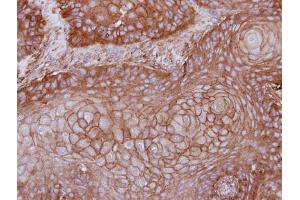 IHC-P Image Immunohistochemical analysis of paraffin-embedded Cal27 xenograft, using MPP1, antibody at 1:100 dilution.