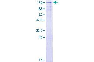 Cbl Proto-Oncogene B, E3 Ubiquitin Protein Ligase (CBLB) (AA 1-982) protein (GST tag)