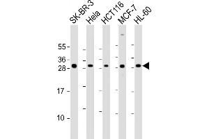All lanes : Anti-N Antibody (Center) at 1:2000 dilution Lane 1: SK-BR-3 whole cell lysate Lane 2: Hela whole cell lysate Lane 3: HC whole cell lysate Lane 4: MCF-7 whole cell lysate Lane 5: HL-60 whole cell lysate Lysates/proteins at 20 μg per lane. (NAA10 抗体  (AA 135-167))