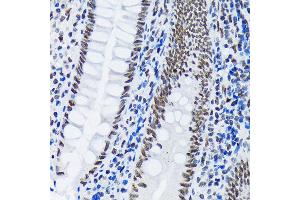 Immunohistochemistry of paraffin-embedded human appendix using PI+PI Rabbit mAb (ABIN7266879) at dilution of 1:100 (40x lens). (E3 SUMO-Protein Ligase PIAS3 (LOC101740849) 抗体)