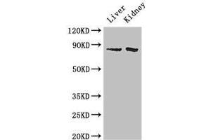Western Blot Positive WB detected in: Mouse liver tissue, Mouse kidney tissue All lanes: SMO antibody at 2 μg/mL Secondary Goat polyclonal to rabbit IgG at 1/50000 dilution Predicted band size: 87 kDa Observed band size: 87 kDa (SMO 抗体  (AA 28-233))