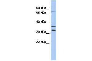 WB Suggested Anti-TSGA13 Antibody Titration: 0. (TSGA13 抗体  (Middle Region))