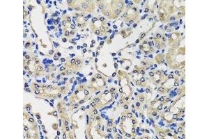 Immunohistochemistry of paraffin-embedded Mouse kidney using SCG3 Polyclonal Antibody at dilution of 1:100 (40x lens). (SCG3 抗体)
