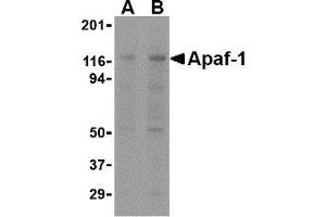 Western Blotting (WB) image for anti-Apoptotic Peptidase Activating Factor 1 (APAF1) antibody (ABIN1031715) (APAF1 抗体)